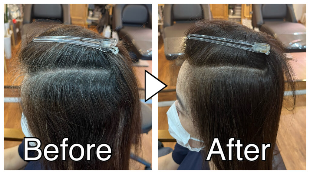 【アトピーで肌が敏感な状態】痒くならずに白髪染めはできますか？