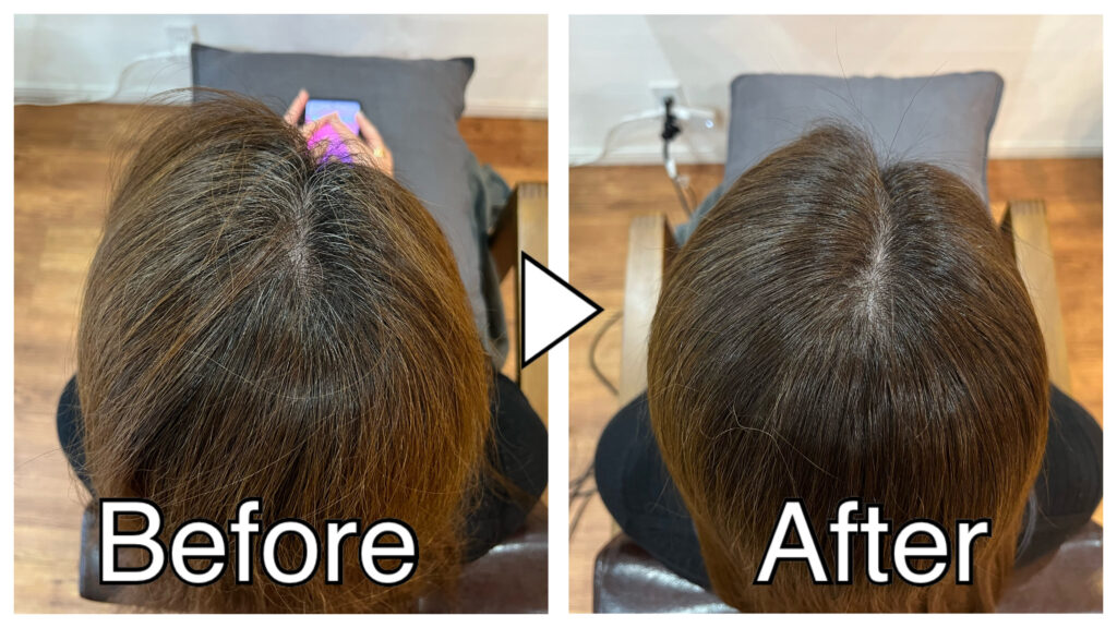 【ヘアカラーでかぶれる】我慢せずにノンジアミンカラーで染める選択