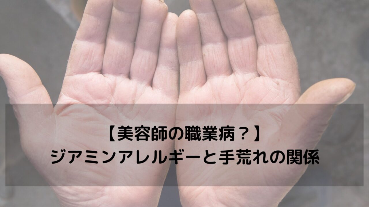 【美容師の職業病？】ジアミンアレルギーと手荒れの関係｜症状・原因・対策を徹底解説