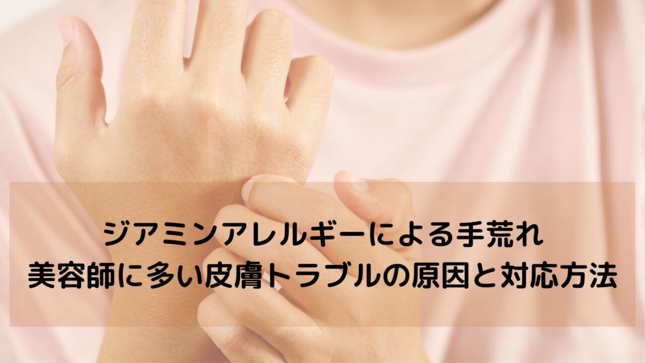 ジアミンアレルギーによる手荒れ｜美容師に多い皮膚トラブルの原因と対応方法