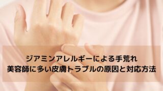 ジアミンアレルギーによる手荒れ｜美容師に多い皮膚トラブルの原因と対応方法