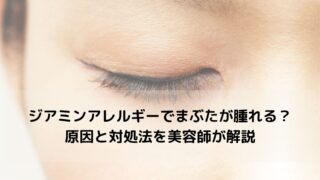 ジアミンアレルギーで「まぶたが腫れる」のはなぜ？原因と対処法を美容師が解説