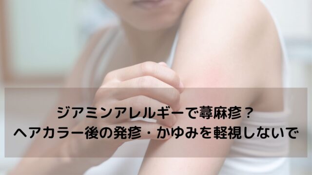 【注意喚起】ジアミンアレルギーで蕁麻疹？ヘアカラー後の発疹・かゆみを軽視しないでください