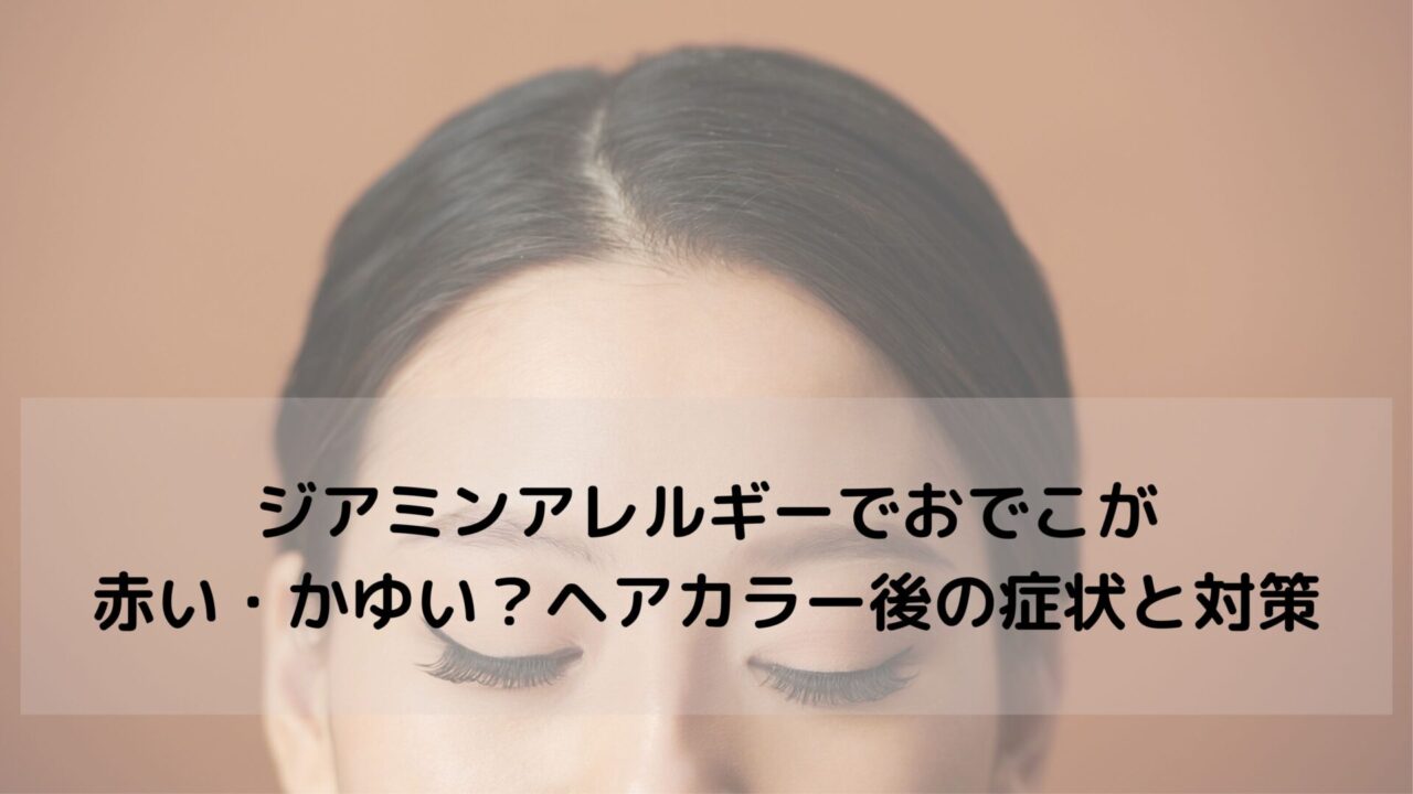 ジアミンアレルギーでおでこが赤い・かゆい？ヘアカラー後の症状と対策を解説